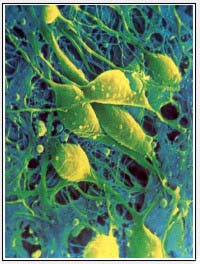 Imagen de un enjambre neuronal tomada con un microscopio electrnico